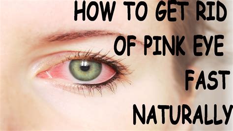 cum in eye porn|Pink Eye